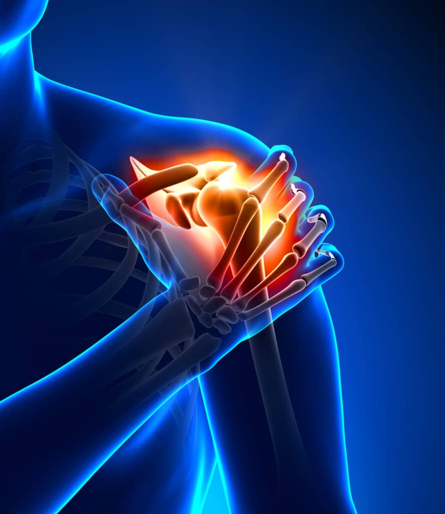 How Can Chiropractic Care Help Shoulder Injuries? Shoulder injuries