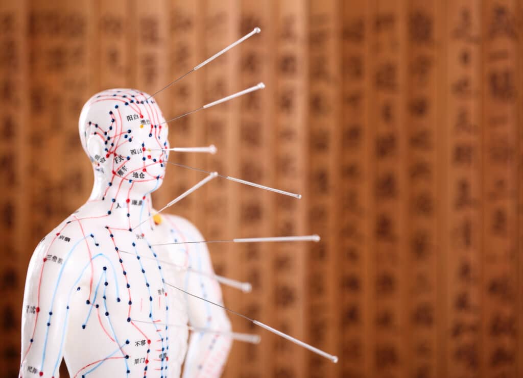 Should You Get Chiropractic Care Or Acupuncture? Chiropractic care or acupuncture in Wenatchee, WA